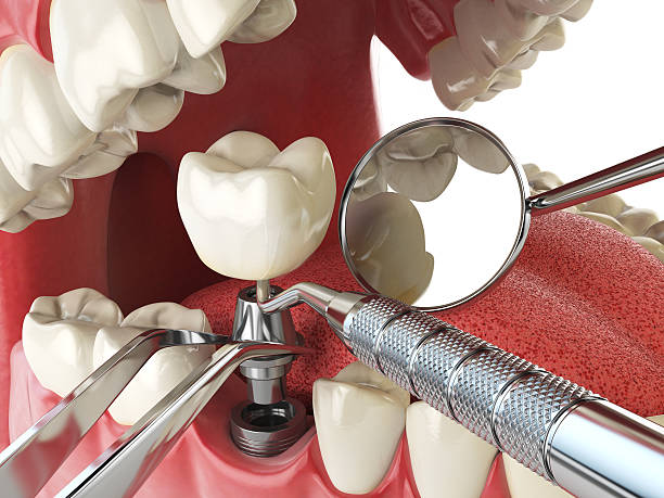 Best Root Canal Emergency Dentist  in Tazewell, VA